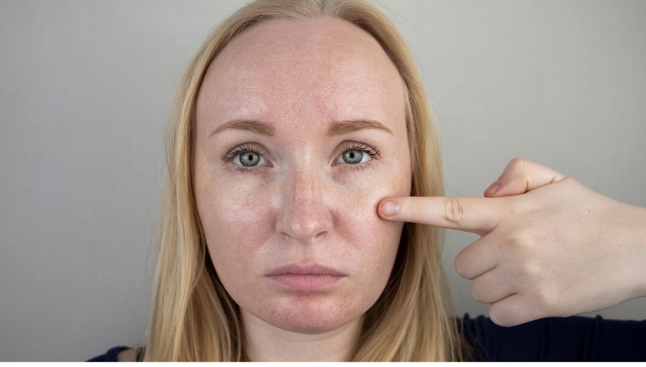 Rutina de Skincare piel grasa
